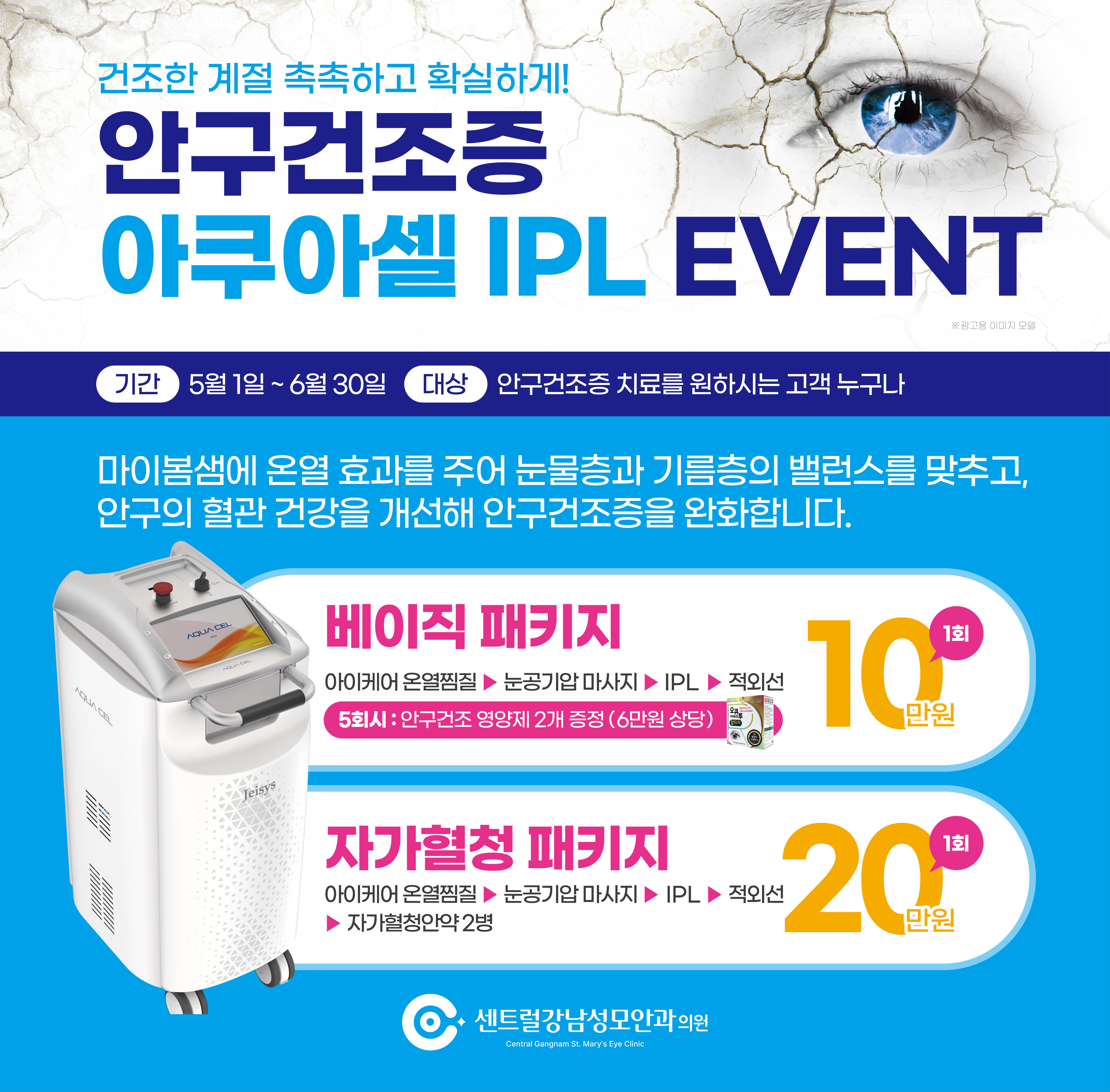 안구건조증 IPL이벤트