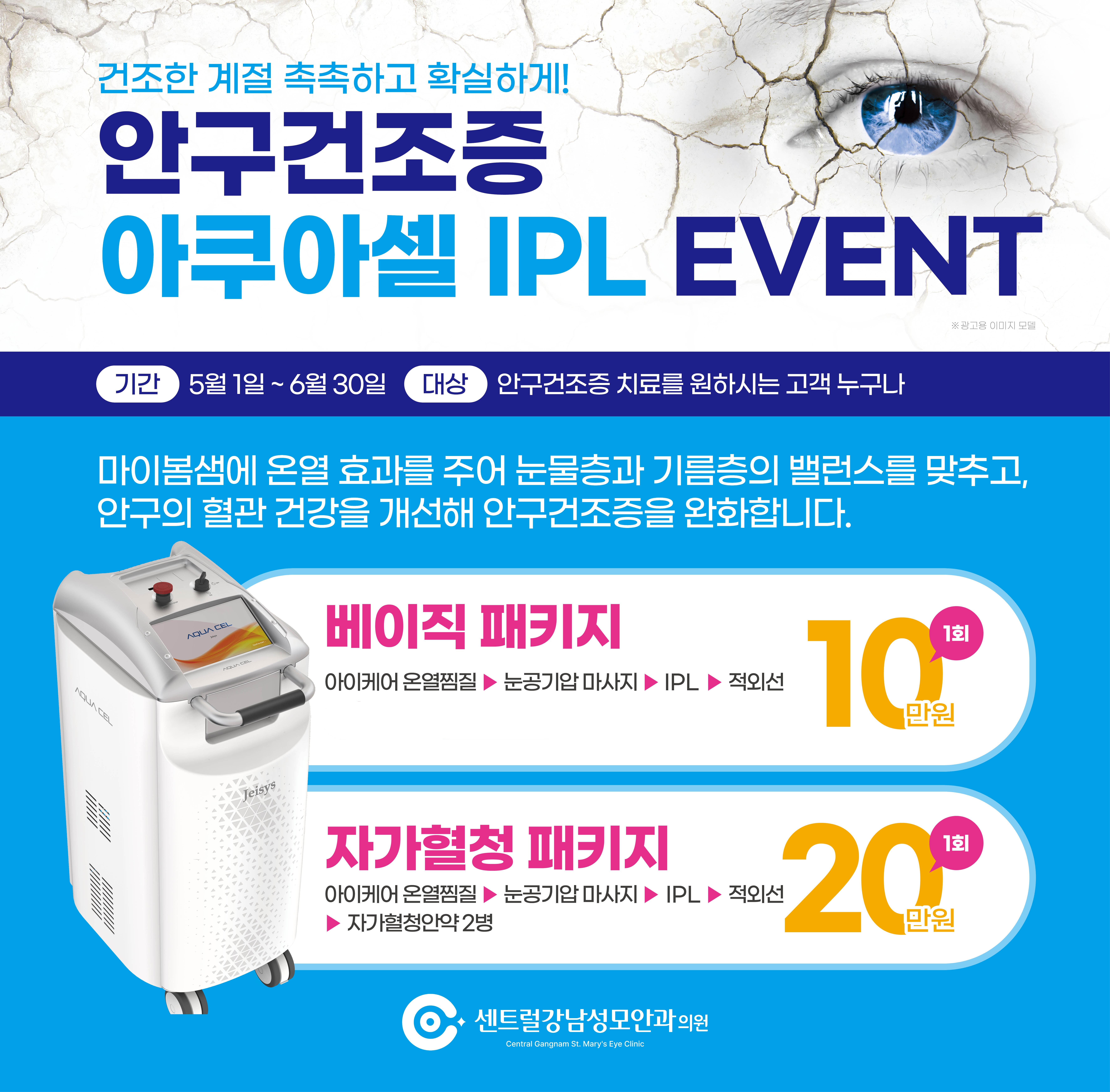 안구건조증이벤트